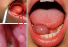 These are the first symptoms of a… See more