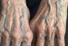 If your veins are visible in your hand, it is a signal of ca… See more