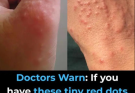 Doctors warn: if you have these tiny red dots on your arm or hand, do not ignore the warning signs