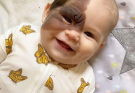 A Beautiful Smile and a One-of-a-Kind Birthmark That Makes This Baby Truly Special