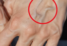 If you have visible veins, it means you are… See more