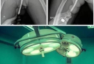 Girl had to be hospitalized for wanting to use a pe…See more