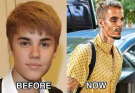 🥺Justin Bieber admits that he tested positive for…See more