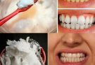 How to Naturally Whiten Your Teeth at Home In 3 Minutes
